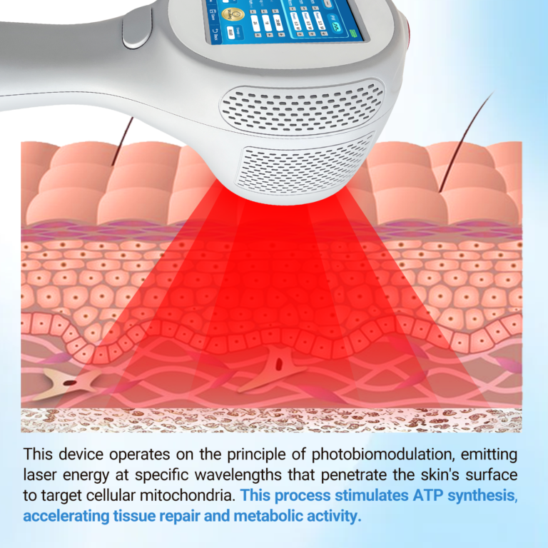 ZJKZ-best cold laser therapy device for home use