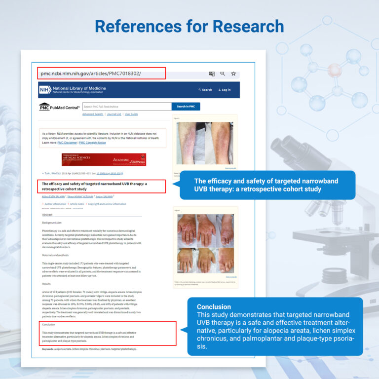 ZJKZ-best vitiligo treatment
