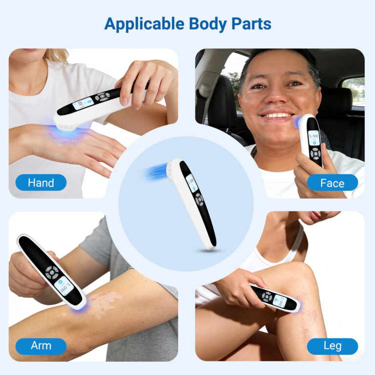 ZJKZ-excimer laser 308