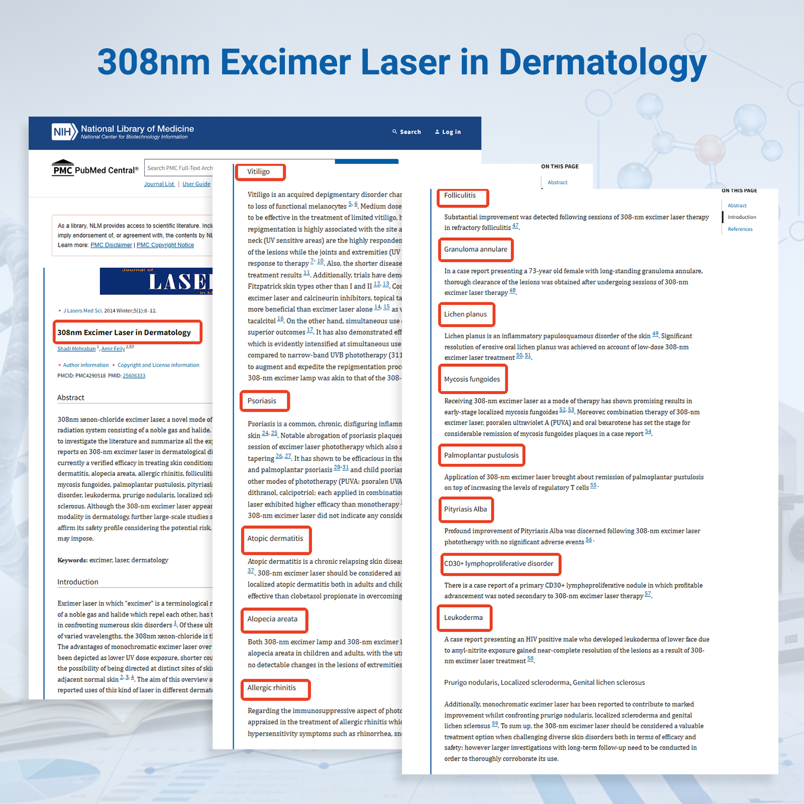 ZJKZ-excimer laser 308 nm