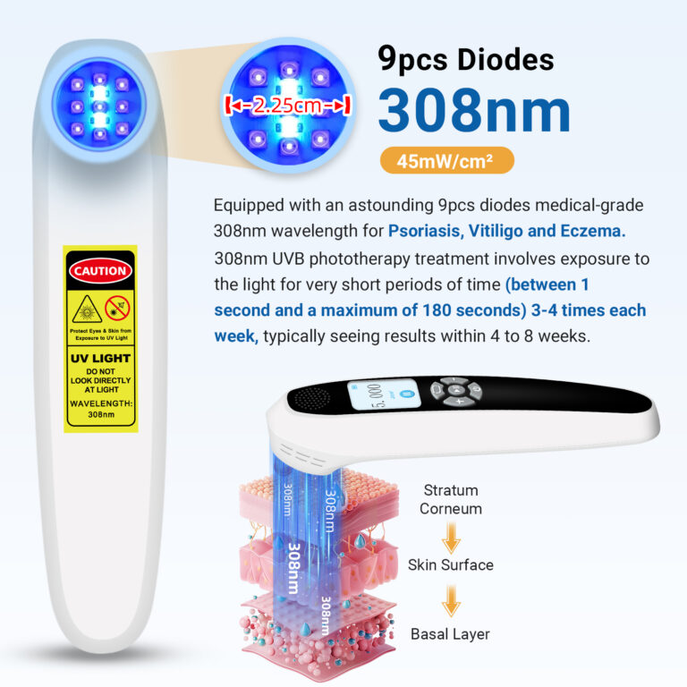 ZJKZ-light therapy for eczema