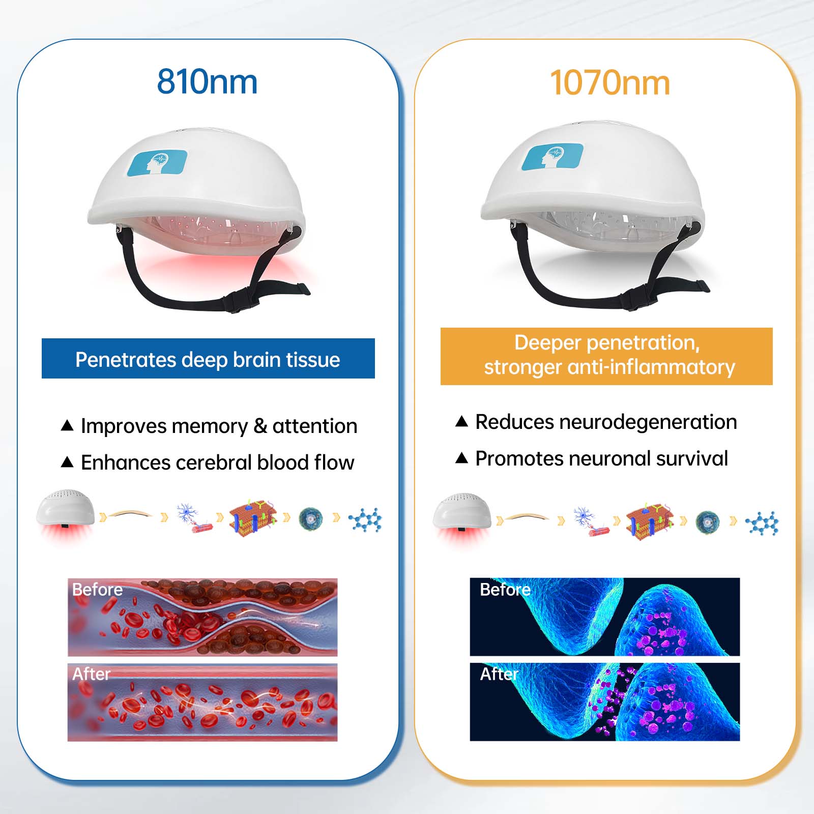 ZJKZ-red light therapy parkinson's
